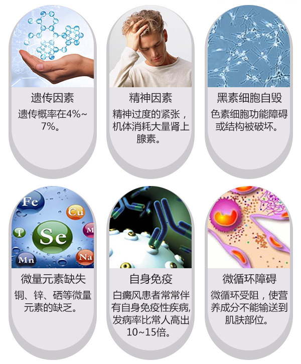 白癜风是怎么引起的