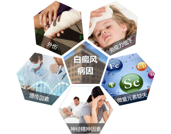 南通看白癜风去哪里,有效预防白癜风复发 从复发病因着手