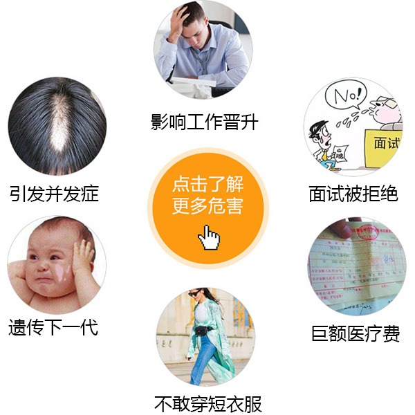 白癜风患者需要注意什么
