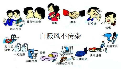 女性白癜风会传染吗？