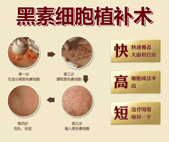 后背长白斑病可不可以做黑色素