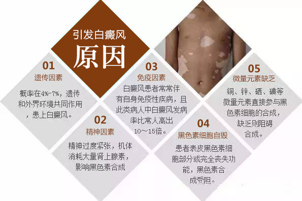 长期接触白癜风患者会传染吗