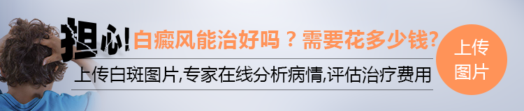白癜风治疗真正费用是什么