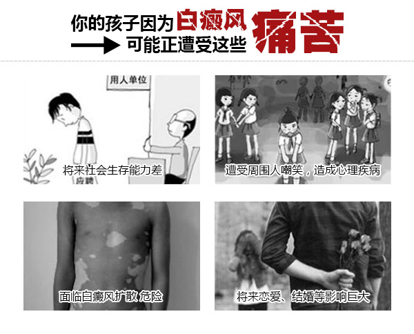 白癜风不严重，不及时治疗危害