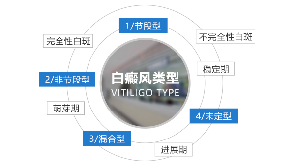 生活中白癜风患者应注意什么
