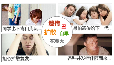 白癜风会伴随其他疾病的出现吗