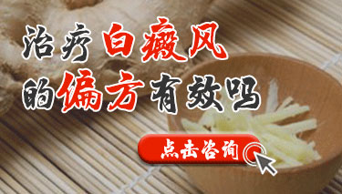 偏方治疗白癜风好吗？