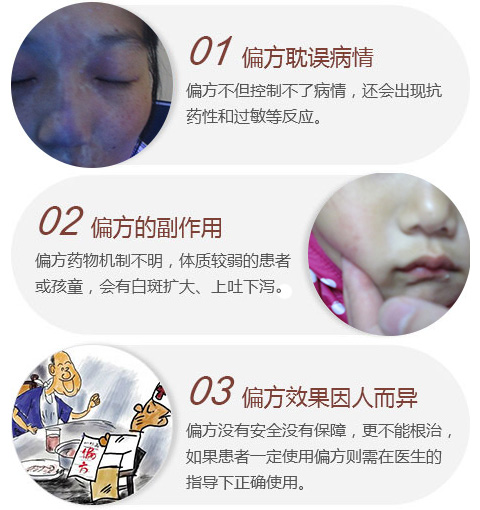 核桃治疗白癜风的偏方好用吗