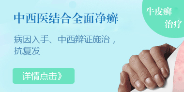 牛皮癣患者在生活中要注意哪些事项？