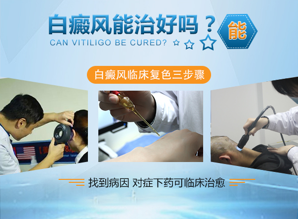 南通专业治疗白癜风医院,南通白癜风专科哪家最好