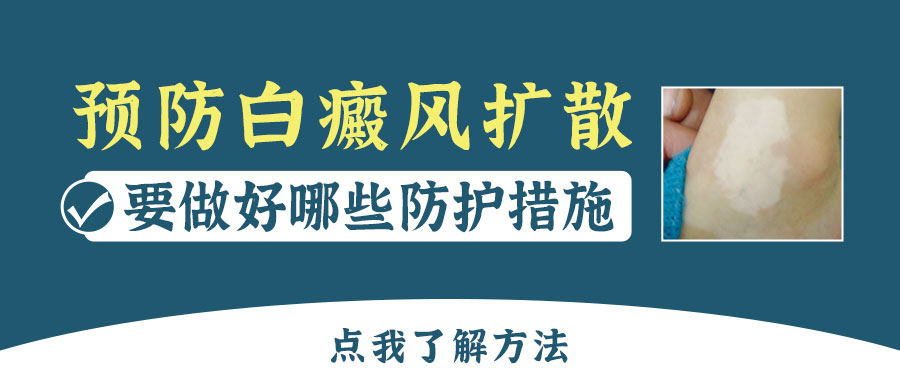 白癜风患者输血指南