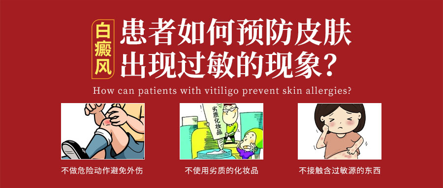 ​手背白癜风：治疗与日常防护策略​
