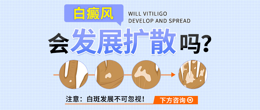 　老年白癜风会传染吗?科学解读与护理要点