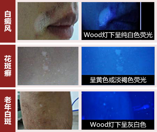 ​白癜风日常护理的四大支柱体系​