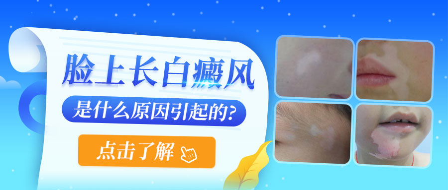 化妆品会诱发白癜风吗?科学解析风险因素​