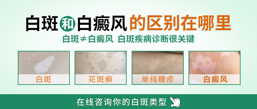 白癜风相似疾病的鉴别诊断指南