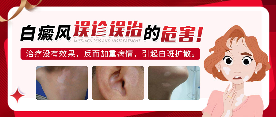 白癜风科学诊断：关键步骤与方法