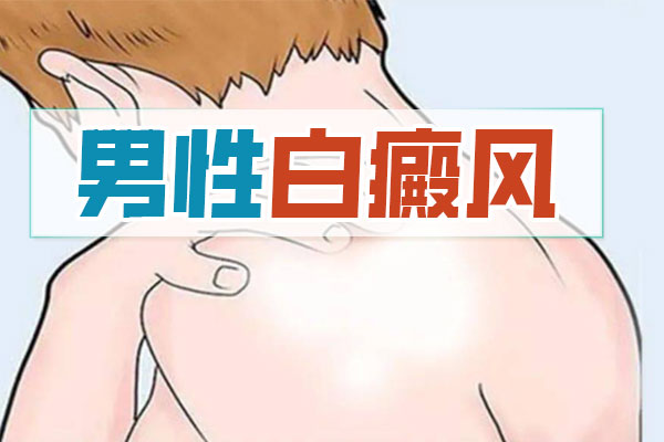 ​男性面部白癜风护肤品选择指南——南通白癜风医院配方解析​