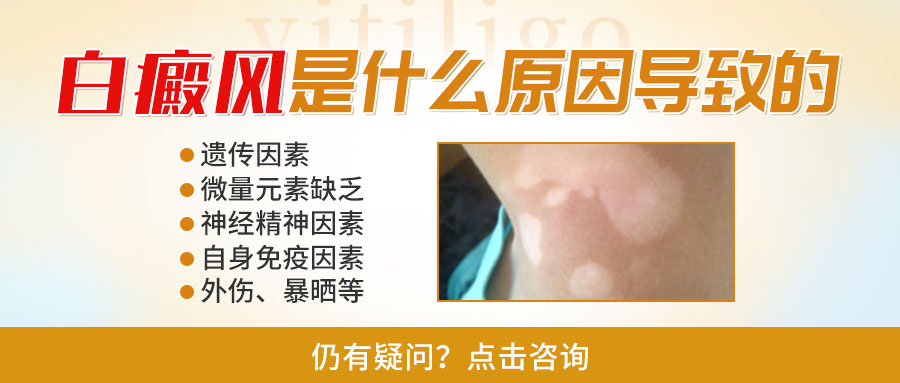 ​头部白斑必知常识