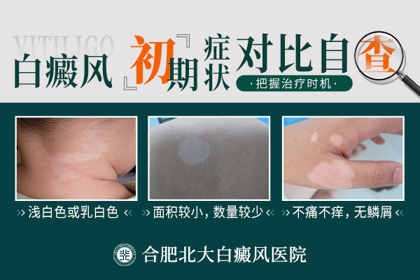 ​臂膀白癜风症状详解：识别与科学应对​