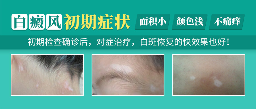 白癜风发病与关键缺乏因素解析
