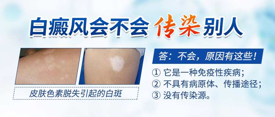 　白癜风传染给他人的几率有多大?