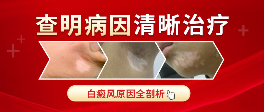 白癜风与白发的关联：机制解析与临床应对