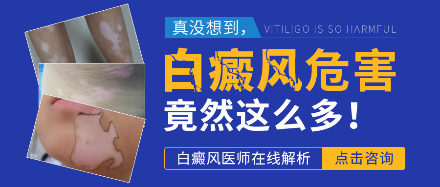 　白癜风可能引发的并发症