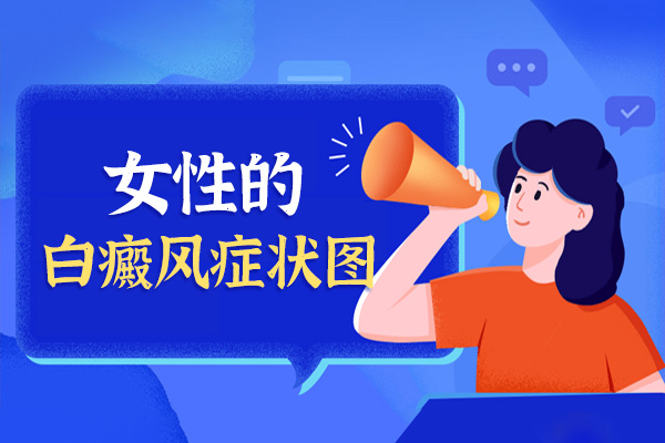 女性肢端型白癜风典型症状